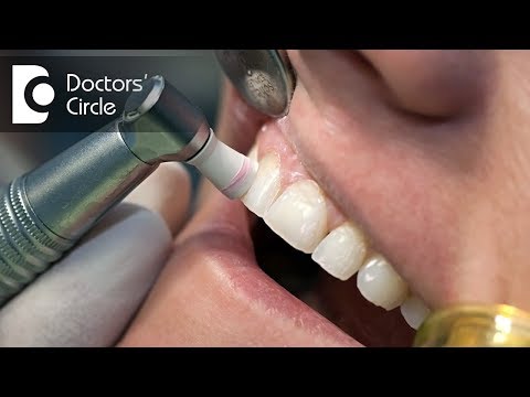 How to get rid of yellow stains on teeth in smokers? - Dr. Aniruddha KB