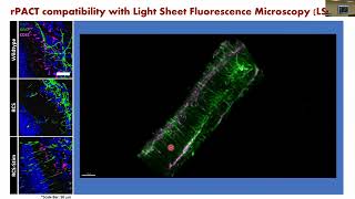 Jennifer Treweek: 3D Analysis of Retinal Degeneration via Tissue Clearing