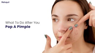 What To Do After You Pop A Pimple
