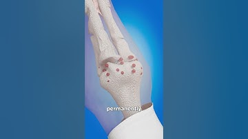 What Happens If You Never Lower Your Arms 😨