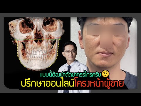 ปรึกษาศัลยกรรมโครงหน้าออนไลน์😁 เคสนี้ต้องผ่าตัดขากรรไกร หรือแค่โครงหน้า❓