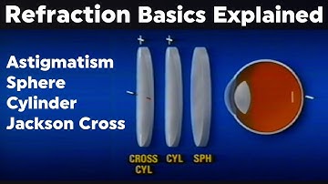 Refraction Explained: How Glasses Work to Correct Vision