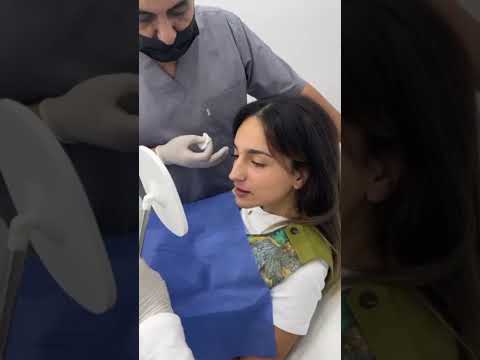 الفيلر المدمج  بتقنية  