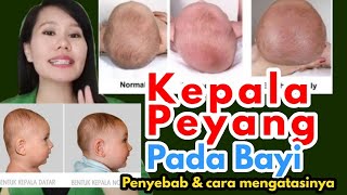 Kepala peyang pada bayi, penyebab & cara mengatasinya