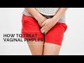 How to Treat Vaginal Pimples and Vulva Acne | Women&#39;s Health