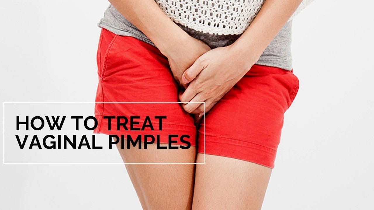 How To Treat Vaginal Pimples And Vulva Acne Women S Health Youtube