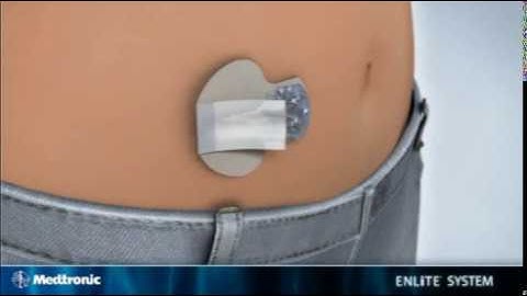 Enlite Insertion | Medtronic Diabetes India