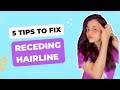 5 easy tips to regrow hair  receding hairline meepratyusha