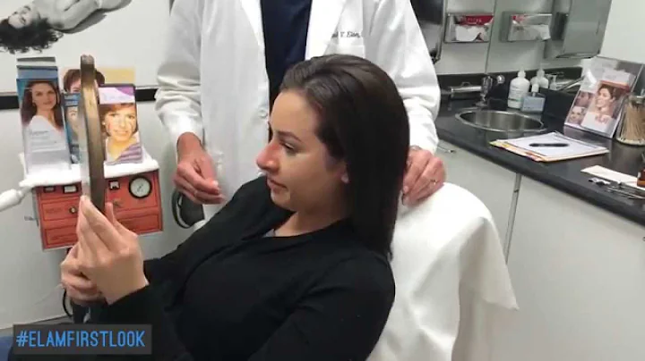 Sandra's Successful Rhinoplasty (Nose Job) Surgery...