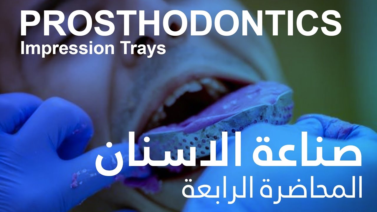 صناعة الاسنان المحاضرة الرابعة - Prosthodontics Impression Trays