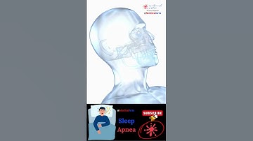 Snoring 💤 Obstructive Sleep Apnea 😴