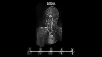 bruckner-2009-IVV-Video 1.avi