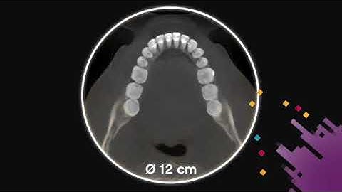 Carestream 8200 CS8200 CBCT