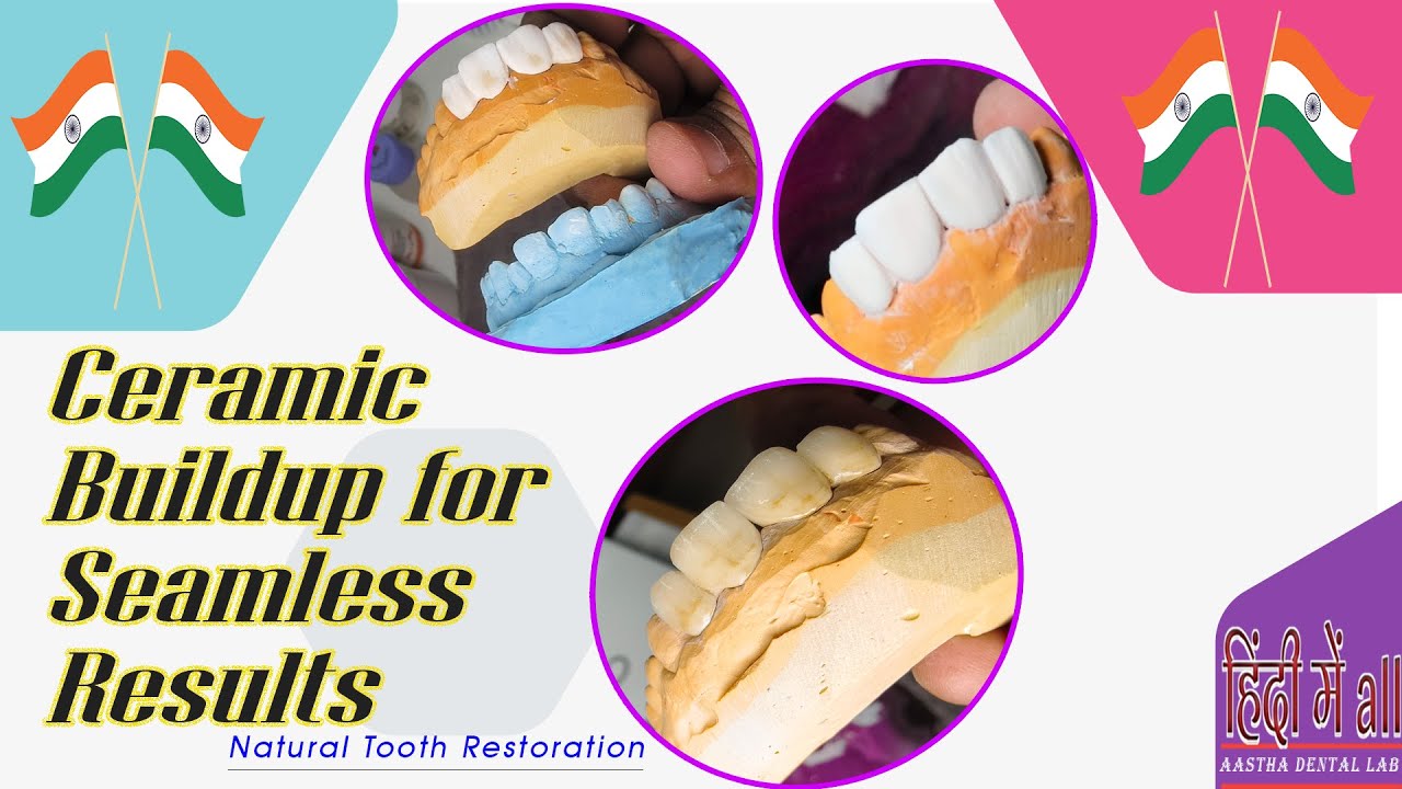 Ceramic build up like original tooth Aesthetic ceramic build up