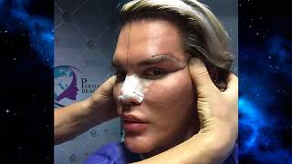 Human Ken Doll 'detained in Dubai' because his plastic fantastic appearance didn't match passport