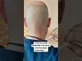 STOP JE LAGE RUGPIJN VIA Deze eenvoudige massage. 👇