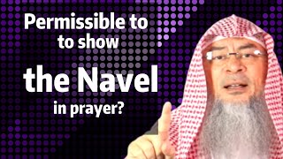 Is It Permissible To Show The Navel In Prayer? Sheikh Im Al Hakeem