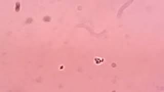 Moving Platelets And Prpdr Lokendra Yumnam Part2