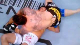 Mir Nougeira arm break