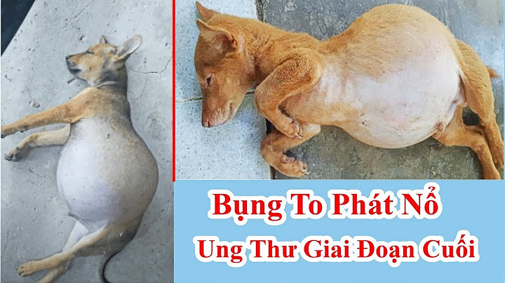 Bụng phình to cứng là bệnh gì năm 2024