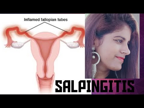 Video: Salpingit - Orsaker Och Symtom På Salpingit