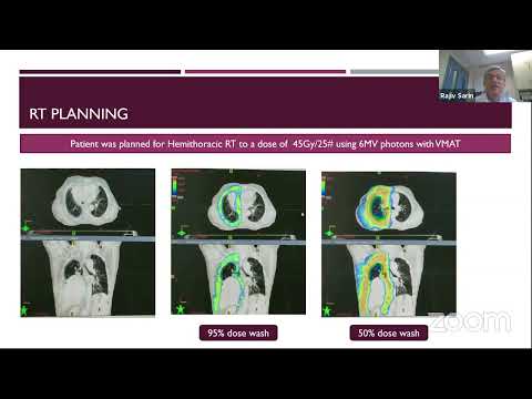 Ward Round - Dr. Rajiv Sarin 13.07.2021