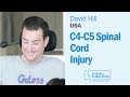 American c4c5 spinal cord injury patient david undergoes epidural stimulation surgery