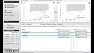 ReSound Aventa - Features instellen - NL