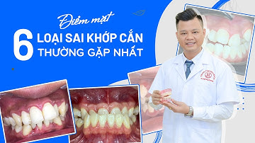 6 LOẠI SAI LỆCH KHỚP CẮN THƯỜNG GẶP | BS NGÔ TÙNG PHƯƠNG