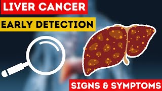 Liver Cancer: Uncovering Causes, Symptoms, & Early Detection