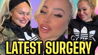 90 Day Fiancé Darcey & Stacey Silva Share Latest Facial Procedure To Look YOUNG! #darceyandstacey