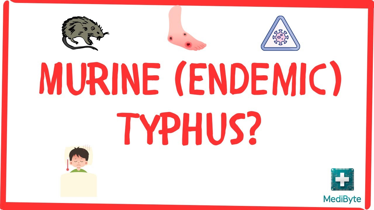 What is Murine (Endemic) Typhus?