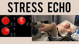 Stress Echo Procedure | Everything you need to know