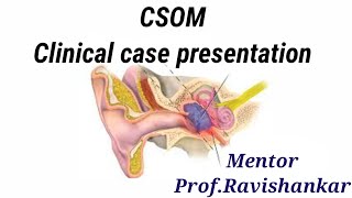 CSOM Clinical case presentation