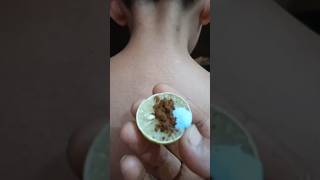 Neck Cleaning Tips |Get a Fair & Clean Neck in 5 Minutes | Remove Neck Darkness Easily #shorts #neck