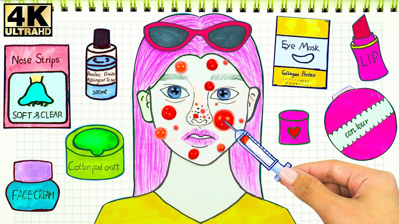[💕Paper DIY 9💕] How To Squeeze Pustules on Your Face 😓여드름 짜기 종이놀이 ASMR
