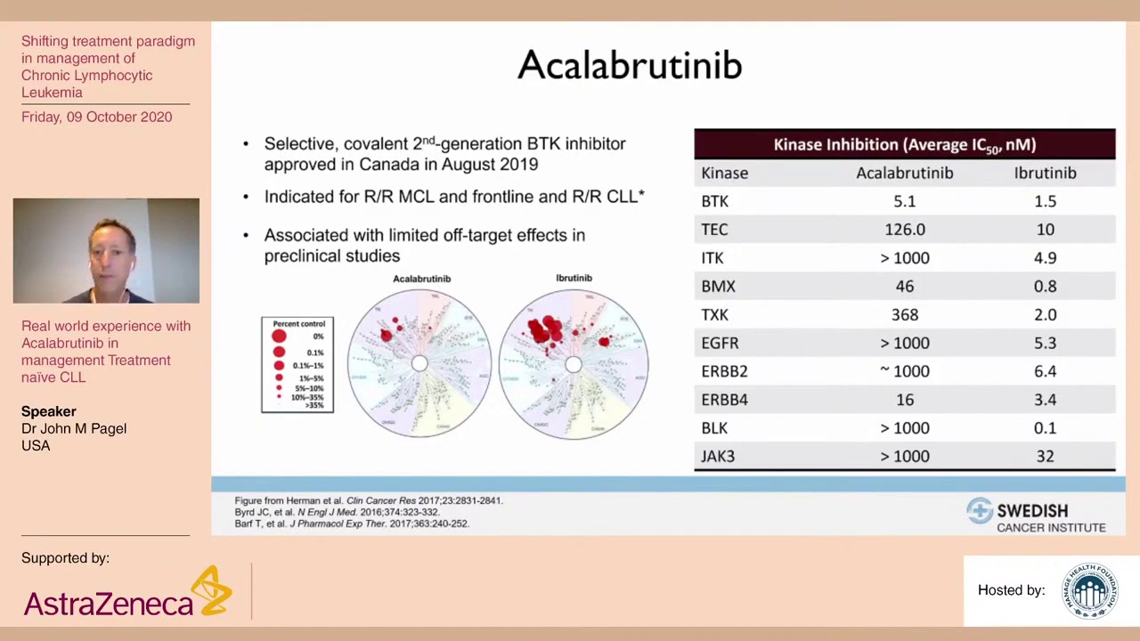 Part 4  Real world experience with Acalabrutinib in management Treatment nave CLL  Dr John M Pagel