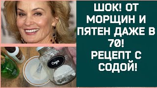 ШОК! ОТ МОРЩИН И ПЯТЕН ДАЖЕ В 70! РЕЦЕПТ С СОДОЙ!