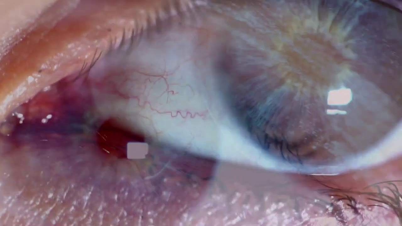 YouTube에서 Visionist - Form (Official Video) 보기 YouTube에서 Visionist - Form (Official Video) 보기