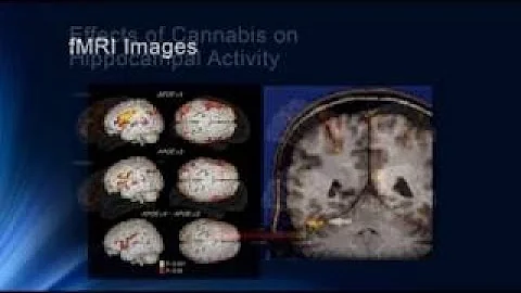 Psychological Research - Crash Course Psychology #2