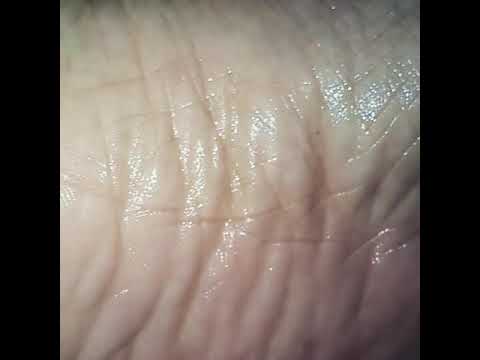 Oily feet