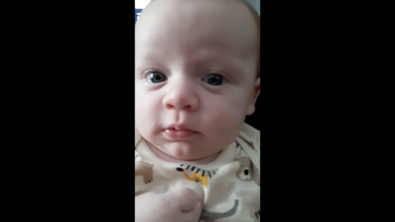 Cleft chin baby cuteness