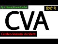 cerebrovascular accident in hindi I cva stroke I cerebrovascular accident nursing