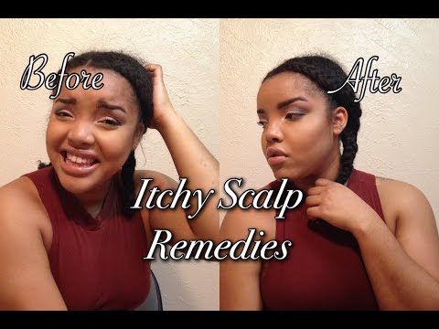 5 Tips Itchy Scalp Remedies For Natural Hair Youtube