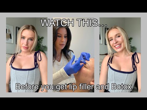 Everything you need to know BEFORE you get lip filler and botox | FAQ