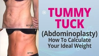 How To Calculate Your Ideal Weight For A Tummy Tuck (Abdominoplasty)