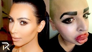 10 Horrible Plastic Surgery Impersonations