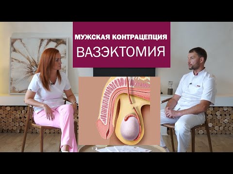 Видео: Как сделать вазэктомию: 8 шагов (с иллюстрациями)