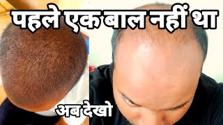 how to grow hair fast | how to control hair fall | how to thick hair naturally| how to strong hair