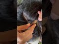 #fypviralシ #statisfying #lice #hair #LiceOnHead #liceremoval  #brasil #xyzbcafyp #licecomb  #kutu